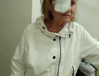Жестокость подростков сделала Ирину инвалидом — поможем ей выстоять
