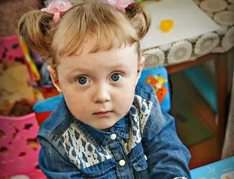 Особенная кожа мешает Ульяне жить полной жизнью, но специальный уход очень помогает